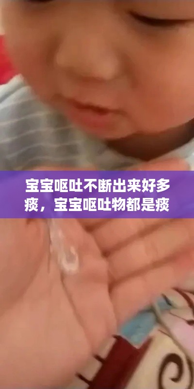宝宝呕吐不断出来好多痰,宝宝呕吐物都是痰