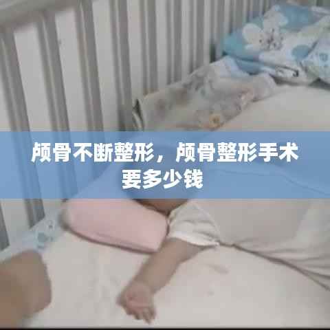 颅骨不断整形,颅骨整形手术要多少钱